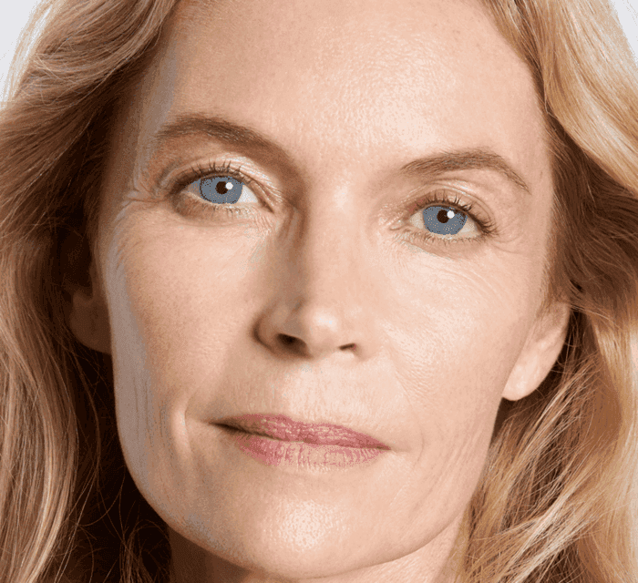 Facial Liposuction
